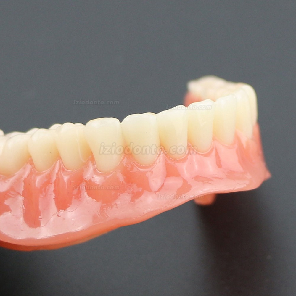 Dentes Inferiores Dentais Modelo 6002 02 Sobredentadura com 4 Implantes